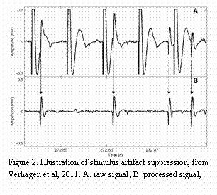 Text Box:    Figure 2. Illustration of stimulus artifact suppression, from Verhagen et al, 2011. A. raw signal; B. processed signal,   